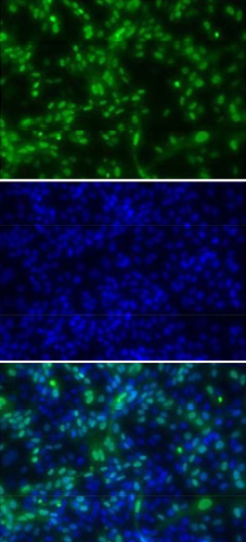 Figure 11 : Immunofluorescence