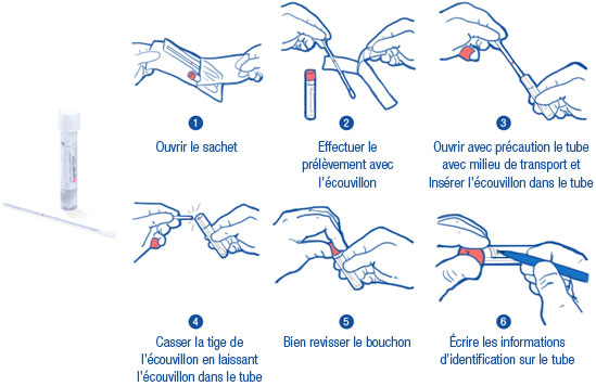 Figure 8 : Instructions prélèvement  « eSwab »